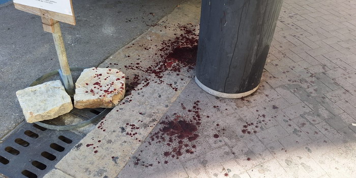 Violenta aggressione sfocia nel sangue con tanto di inseguimento in pieno centro storico a Modica: indagini delle forze dell’ordine